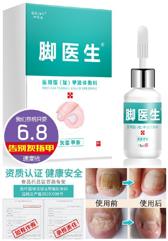 【脚医生】灰指甲甲沟炎专用药原价56.8元【券后6.8元】包邮